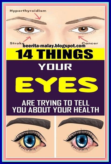 14 Things Your Eyes Are Trying To Tell You About Your Health Artofit