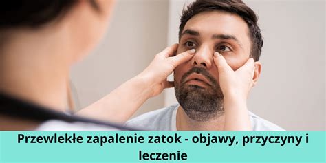 Przewlekłe zapalenie zatok objawy leczenie i przyczyny