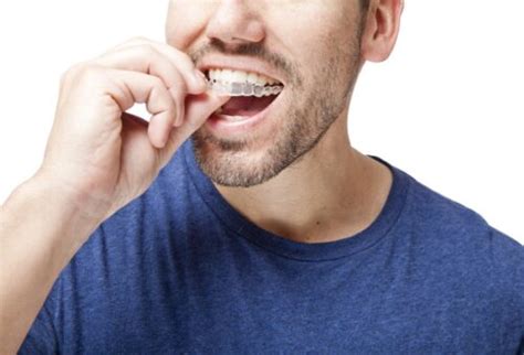 What Is Invisalign Orthodontist In Fort Collins Colorado