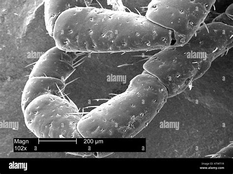 Rickettsia Rickettsii Microscope