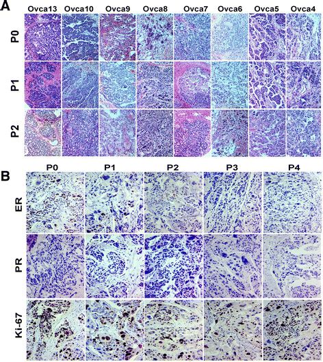 Histology And Immunohistochemistry Analysis Of Primary P0 And PDX