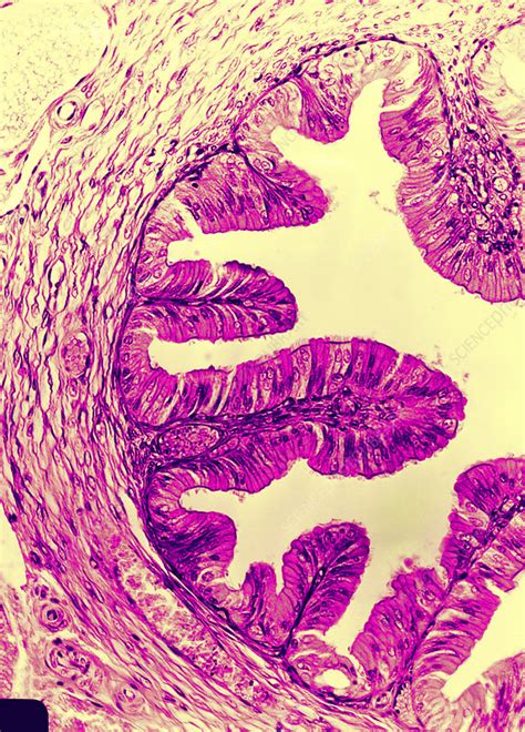 Fallopian Tube Histology Labeled