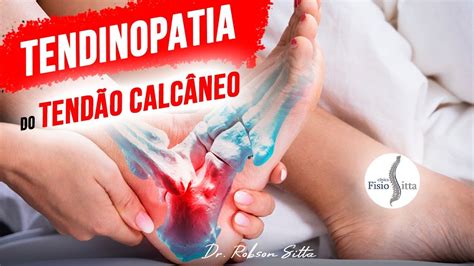 Tratamento Tendinopatia Do Tend O Calc Neo Aquiles Cl Nica Dr