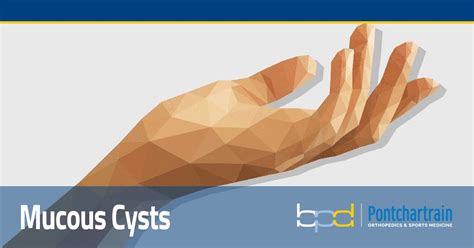 Mucous Cysts Hand Specialist Brandon P Donnelly Md