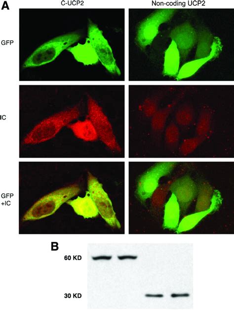 Mitochondrial Uncoupling Protein 2 Induces Cell Cycle Arrest And