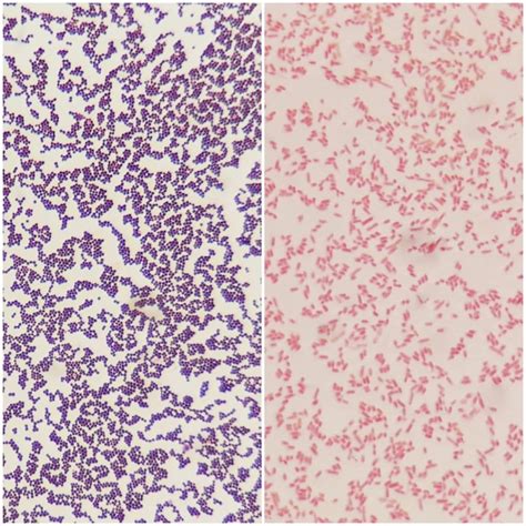 Streptococcus Vs Staphylococcus Gram Stain