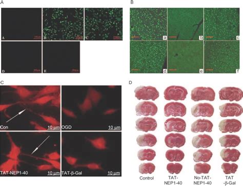 Transduction Of Tat Nep And Its Biological Activity A