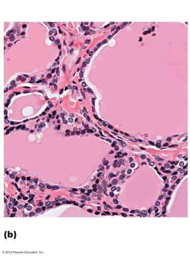 Urinary Endocrine Histology Flashcards Quizlet