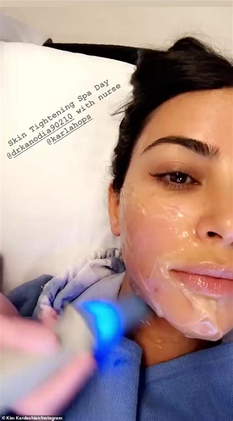 Kim Kardashian Gets Skin Tightening Treatment In Beverly Hills