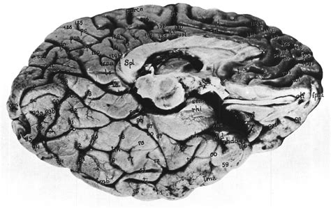 The Human Brain Atlas Of The Human Brain Structures