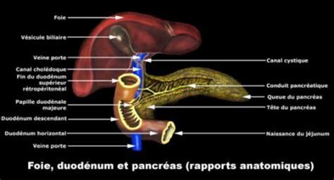 Pancreatitis Cr Nica Causes S Mptomes Tractament Vulgaris Medical