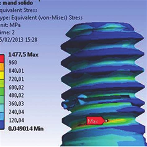 Maximum Stress Found At R1 Abutment Retaining Screw 2 S For The M1 Download Scientific