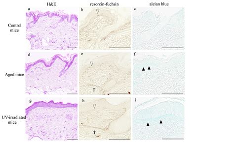 Differences In The Histopathology And Cytokine Expression Pattern