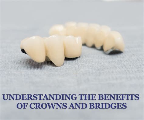 Understanding The Benefits Of Crowns And Bridges Fabulous Smiles Of