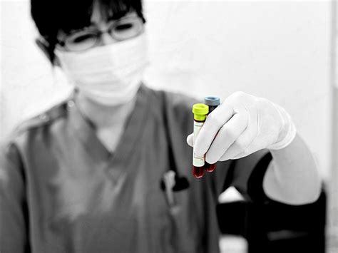 What is the D-dimer normal range?