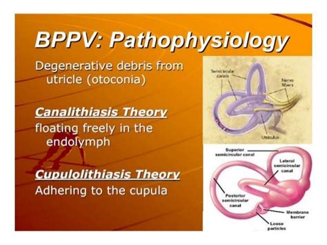 Vertigo and peripheral vestibular disorders