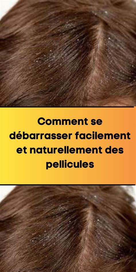 Comment se débarrasser facilement et naturellement des pellicules