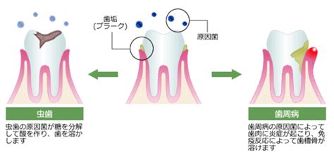 むし歯・歯周病予防 歯科矯正ちどり歯科医院