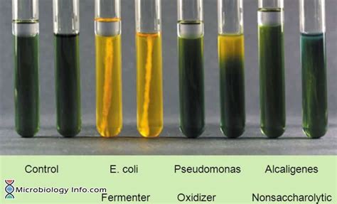 Biochemical Test Archives Microbiology