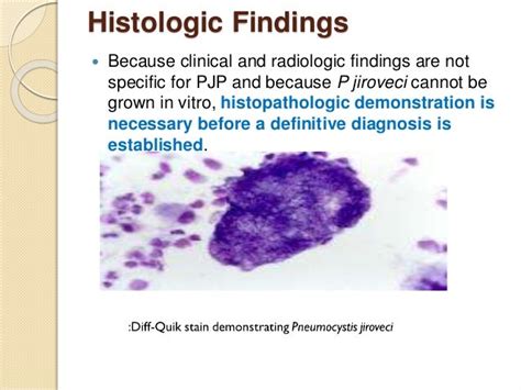 Pneumocystis Pneumonia