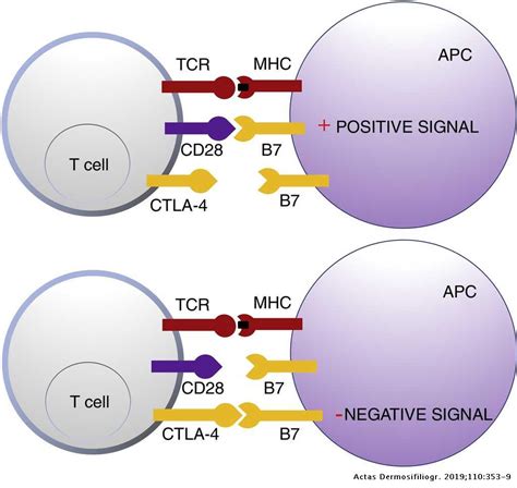 Immunotherapy In Nonmelanoma Skin Cancer Actas Dermo Sifiliográficas