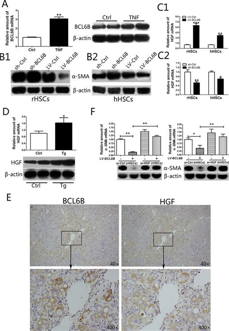 Bcl6b Inhibits The Activation Of Hepatic Stellate Cells Hscs Through Download Scientific