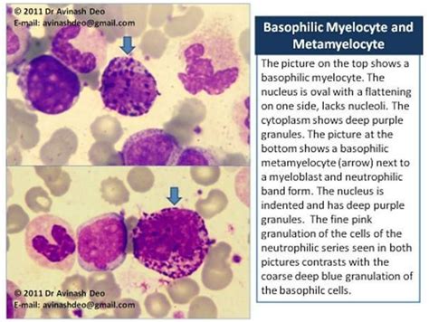 Morphology Of Myeloid Precurssors In 2020 Medical Laboratory