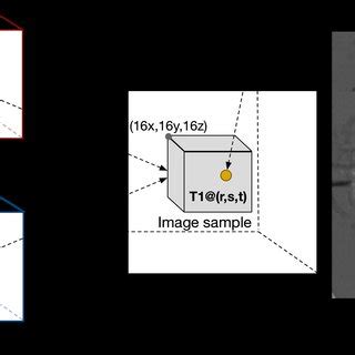 Artificial Intelligence AI Based Medical Image Segmentation For 3D