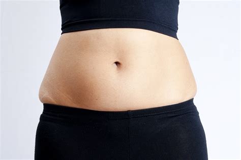 Cancer De Ovario Incha A Barriga - Inchaco Abdominal Cancer De Ovario Diagnóstico Tardio Dificulta