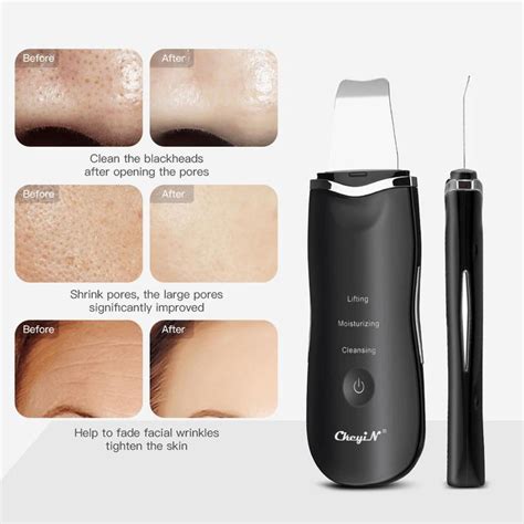 Ultrasonic Ion Nettoyage En Profondeur Purateur De Peau Pelle