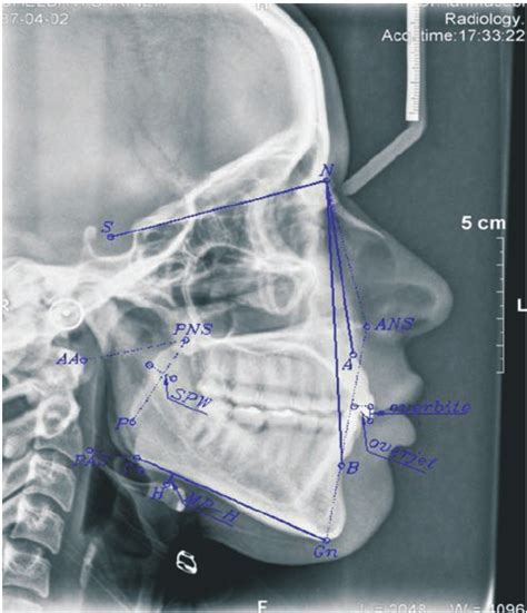 Graphic Description Definitions And Measures Of Cephalometric