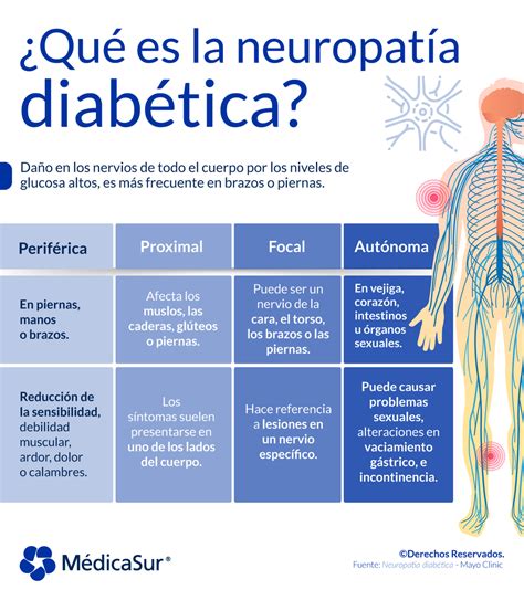 Médica Sur On Twitter ¡la Neuropatía Diabética Puede Afectar Al 50 De Las Personas Con