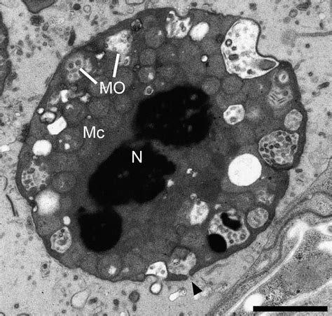 Ditylenchus Arachis Non Activated Spermatozoon In Female Uterus Tem