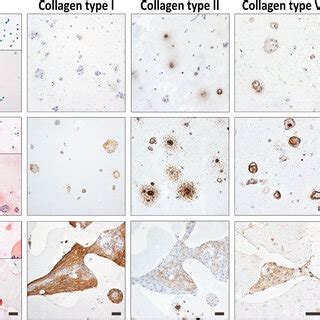 Overview of the histology and immunohistochemistry of chondrocytes ...