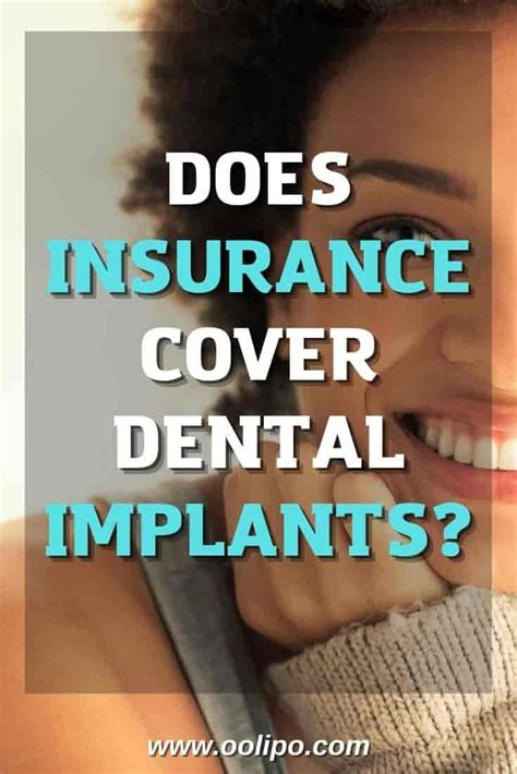 How Much Do Dental Implants Cost Price Range And Average Oolipo