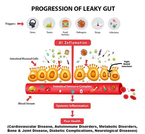 Leaky-Gut-Syndrome - Finally Calmed & Focused