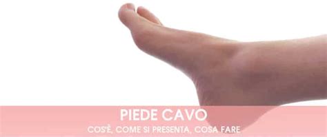 Piede Cavo Sintomi Cause E Rimedi Fisiopodos