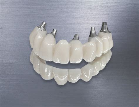 Crown And Bridge Zirconia Composite And Ceramics