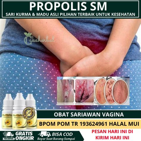 Obat Herbal Sariawan Vagina Luka Lecet Di Vagina Luka Mirip Sariawan