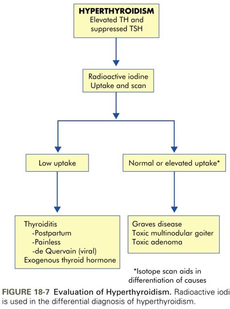 Hyperthyroidism Diagram