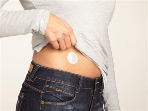 Инъекционный порт Ай-Порт (iPort Advance™) Medtronic 6мм