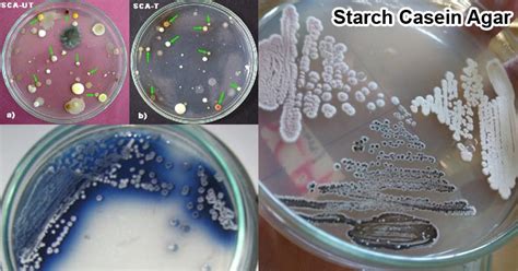 Starch Casein Agar SCA Composition Principle Preparation Results