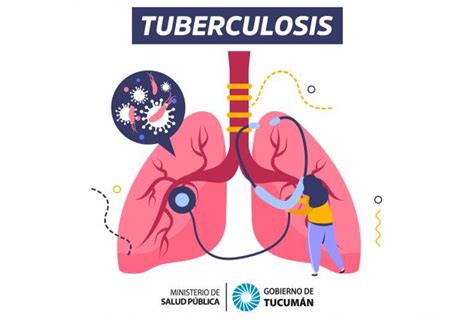 La Salud P Blica Atiende A Pacientes Con Tuberculosis De Forma Gratuita