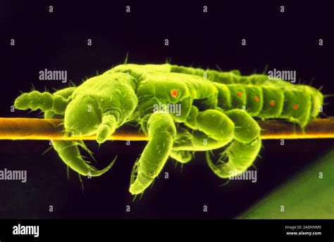 False Colour Scanning Electron Micrograph Sem Of A Human Head Louse