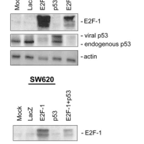 Overexpression Of E2f 1 And P53 Through Adenoviral Gene Transfer In