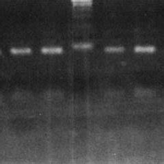 Photograph Of Ethidium Bromide Stained Agarose Gel Electrophoresis