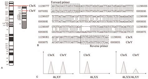Molecular Diagnosis Of Sex Chromosome Mosaics In Fetal Amnio Medicine