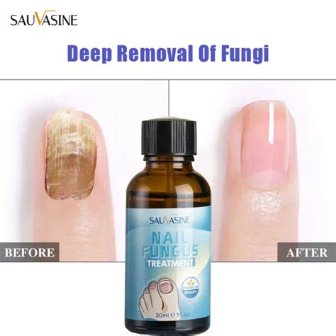 SAUVASINE Nail Repair Essence Serum Fungal Nail Treatment Remove