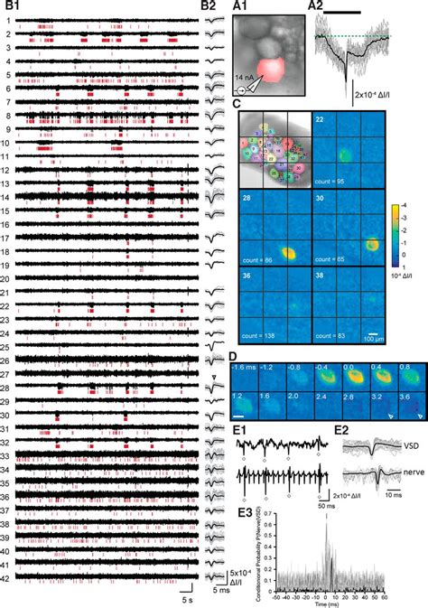 Unique Configurations Of Compression And Truncation Of Neuronal