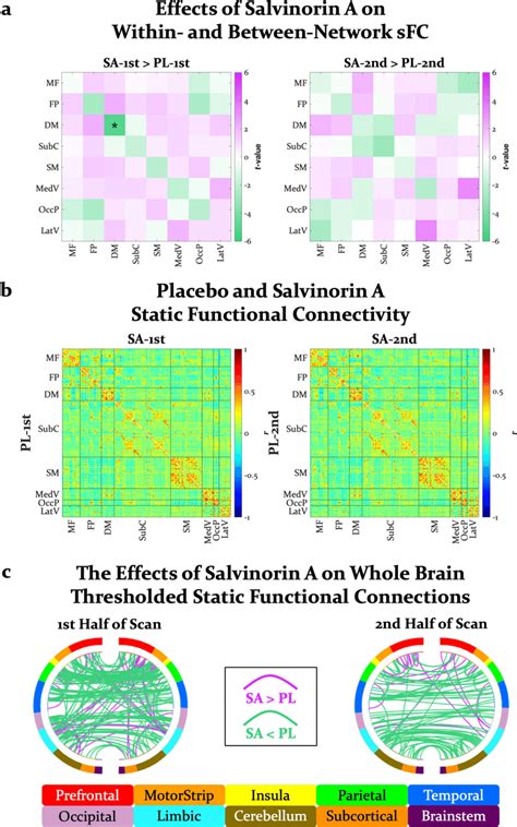 A Differences T Values In Static Functional Connectivity Within